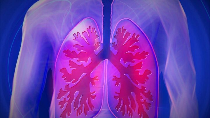 Sintomas de bronquite: como reconhecer