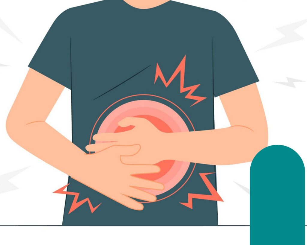 Cirurgia de Hérnia Inguinal por Videolaparoscopia