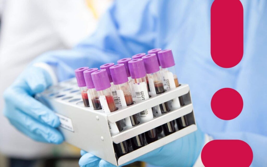 Ampolas de exame de sangue